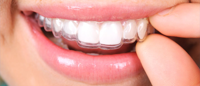 Clear Teeth